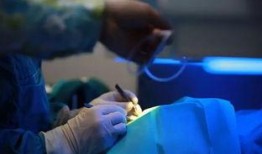 近视激光手术爆料视频,真实爆料视频背后的真相与风险